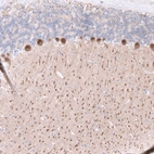 Immunohistochemical staining of mouse cerebellum shows moderate cytoplasmic positivity in Purkinje cells.