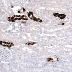 Immunohistochemical staining of human kidney shows strong cytoplasmic positivity in cells in tubules.