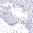 Immunohistochemical staining of human prostate shows no positivity in glandular cells as expected.