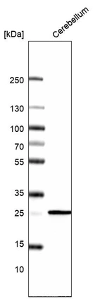 Western blot analysis in human cerebellum tissue.