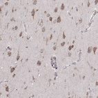 Immunohistochemical staining of human cerebral cortex shows moderate cytoplasmic positivity in neurons.