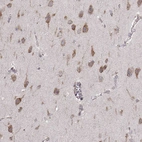 Immunohistochemical staining of human cerebral cortex shows moderate cytoplasmic positivity in neurons.
