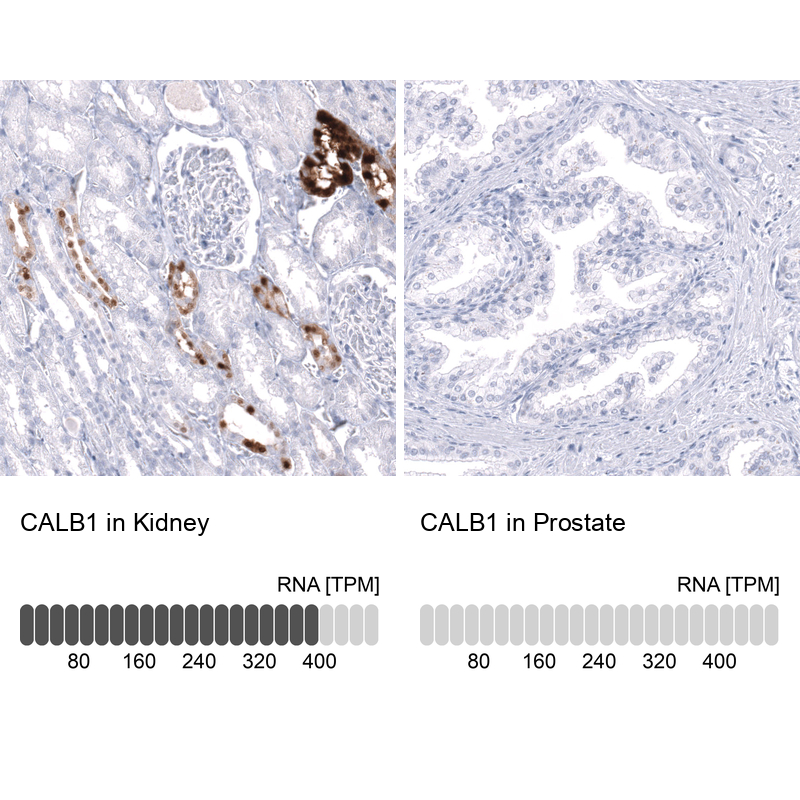 Anti-CALB1 Antibody