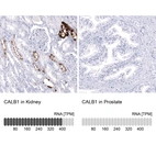 Anti-CALB1 Antibody