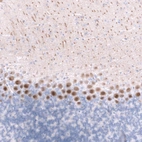 Immunohistochemical staining of mouse cerebellum shows strong cytoplasmic positivity in Purkinje cells.
