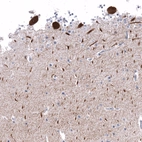 Immunohistochemical staining of human cerebellum shows strong cytoplasmic positivity in Purkinje cells.