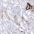 Immunohistochemical staining of human kidney shows strong cytoplasmic positivity in cells in tubules.