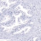 Immunohistochemical staining of human prostate shows no positivity in glandular cells as expected.