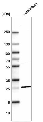 Western blot analysis in human cerebellum tissue.