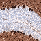 Immunohistochemical staining of rat cerebellum shows strong cytoplasmic positivity in Purkinje cells.