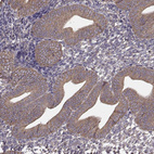 Anti-PDIA3 Antibody