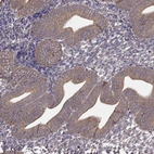 Immunohistochemical staining of human endometrium shows moderate cytoplasmic positivity in glandular cells.