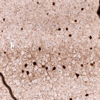 Immunohistochemical staining of mouse cerebral cortex shows strong cytoplasmic positivity in neurons.