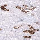 Immunohistochemical staining of human kidney shows strong cytoplasmic positivity in cells in tubules.
