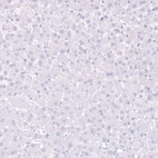 Immunohistochemical staining of human liver shows no positivity in hepatocytes as expected.