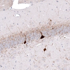 Immunohistochemical staining of rat hippocampus shows strong cytoplasmic positivity in a subset of neurons.
