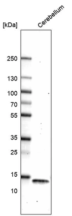 Western blot analysis in human cerebellum tissue.