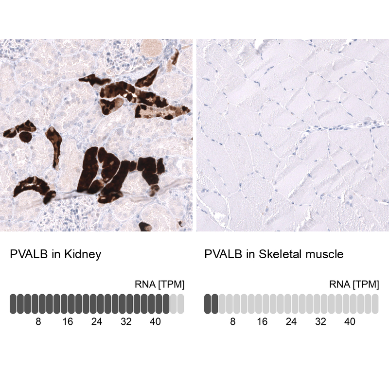 Anti-PVALB Antibody