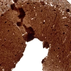 Immunohistochemical staining of human cerebellum shows strong cytoplasmic positivity in Purkinje cells.