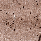 Immunohistochemical staining of mouse cerebral cortex shows strong cytoplasmic positivity in a subset of neurons.