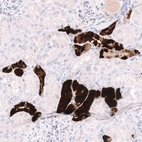 Immunohistochemical staining of human kidney shows strong cytoplasmic positivity in cells in tubules.