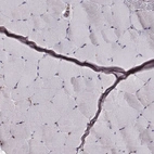 Immunohistochemical staining of human skeletal muscle shows no positivity in striated muscle fibers as expected.