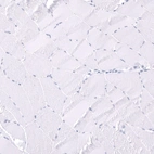 Immunohistochemical staining of human skeletal muscle shows no positivity in myocytes as expected.