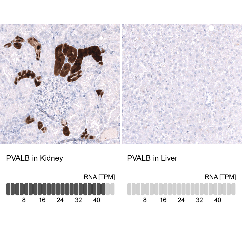 Anti-PVALB Antibody
