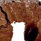 Immunohistochemical staining of human cerebellum shows strong cytoplasmic positivity in Purkinje cells.