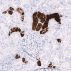 Immunohistochemical staining of human kidney shows strong cytoplasmic positivity in cells in tubules.