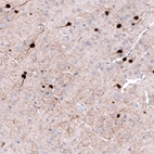 Immunohistochemical staining of rat cerebral cortex shows strong cytoplasmic positivity in neurons.