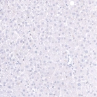 Immunohistochemical staining of human liver shows no positivity in hepatocytes as expected.