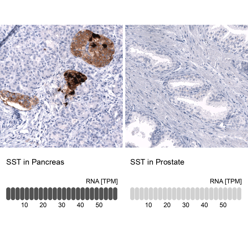Anti-SST Antibody