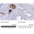Anti-SST Antibody