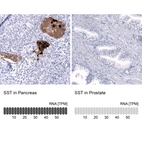 Anti-SST Antibody