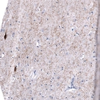 Immunohistochemical staining of human cerebral cortex shows moderate to strong cytoplasmic positivity in a subset of neurons and in neuronal processes.