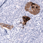 Immunohistochemical staining of human pancreas shows strong cytoplasmic positivity in endocrine glandular cells in islets of Langerhans.