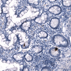 Immunohistochemical staining of human small intestine shows strong cytoplasmic positivity in enteroendocrine cells.