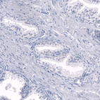 Immunohistochemical staining of human prostate shows no positivity in glandular cells as expected.