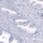 Immunohistochemical staining of human prostate shows no positivity in glandular cells as expected.