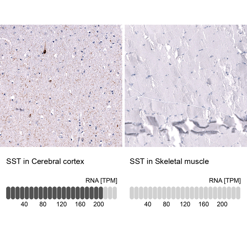 Anti-SST Antibody