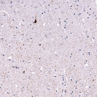 Immunohistochemical staining of human cerebral cortex shows strong cytoplasmic positivity in a subset of neurons and neuronal processes.