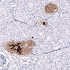 Immunohistochemical staining of human pancreas shows moderate to strong cytoplasmic positivity in islets of Langerhans.