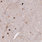 Immunohistochemical staining of rat cerebral cortex shows strong cytoplasmic positivity in neurons and neuronal processes.