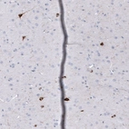 Immunohistochemical staining of mouse cerebral cortex shows strong cytoplasmic positivity in a subset of neurons and neuronal processes.