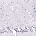Immunohistochemical staining of human skeletal muscle shows no positivity in myocytes as expected.
