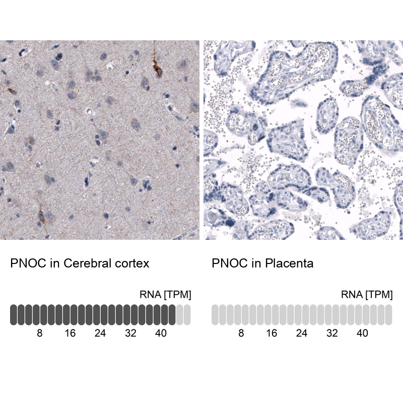 Anti-PNOC Antibody