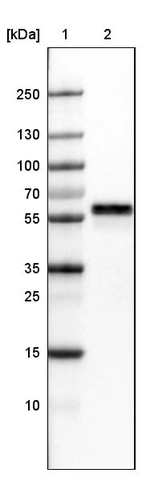 Lane 1: Marker [kDa]_br/_Lane 2:Human cell line U-251 MG