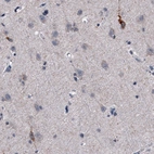 Immunohistochemical staining of human cerebral cortex shows weak to moderate cytoplasmic positivity in a subset of neurons.