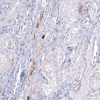 Immunohistochemical staining of human kidney shows moderate cytoplasmic positivity in cells in tubules.
